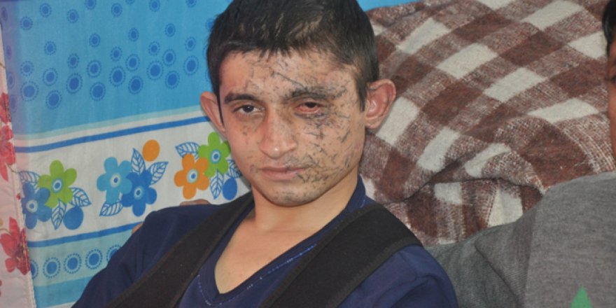 Kayseri patlaması gazisi evine döndü