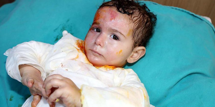 Suriyeli Ala bebek Sivas'ta yaşama tutundu