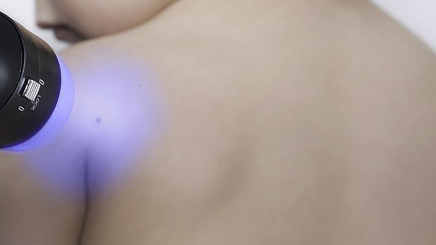 'Ciltten gelen sinyaller hastalık habercisi olabilir'