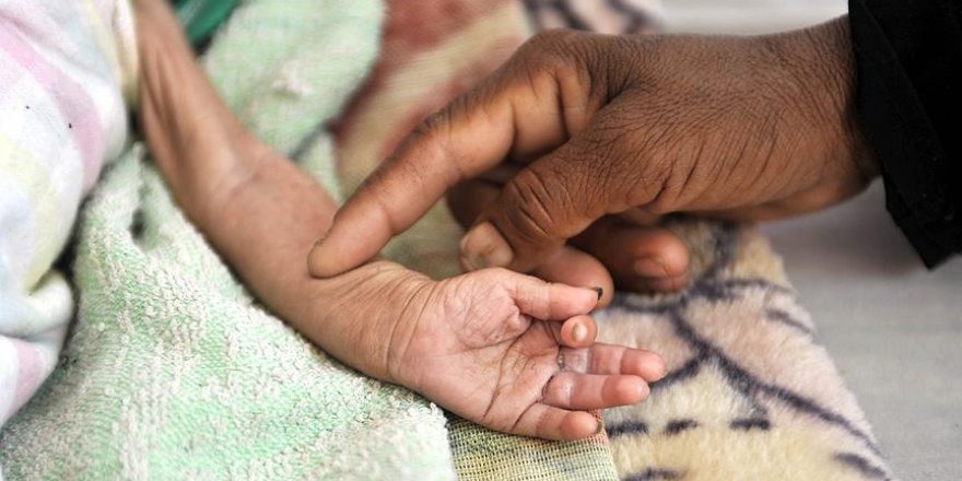 Açlık tehdidindeki Yemen için yardım çağrısı