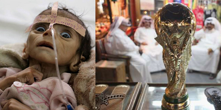 Yemen açlıktan ölüyor, Katar futbola 200 milyar dolar harcıyor