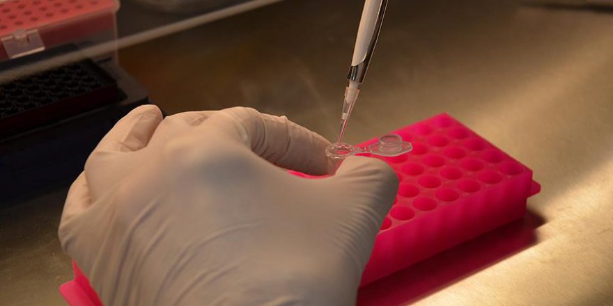 New York'ta fareden bulaşan hastalık endişeye yol açtı