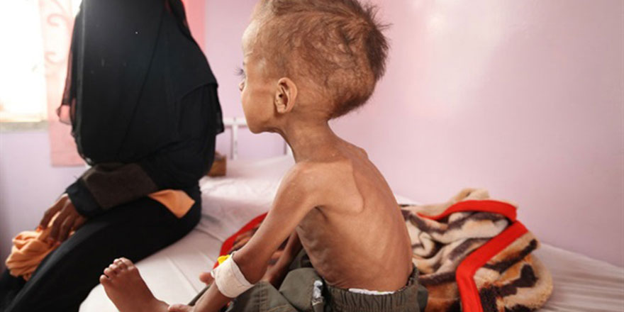 Afrika'da 20 milyon kişi açlık tehlikesiyle karşı karşıya