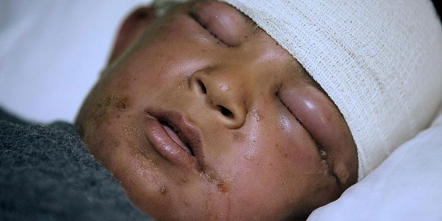 Musul'da kimyasal şüphesi