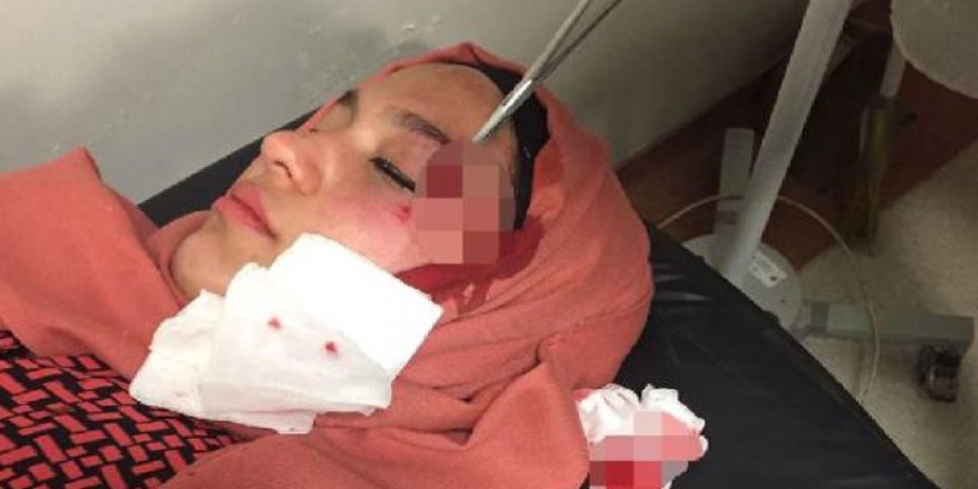 'Evet' broşürü dağıtan AK Partili kadınlara taşlı saldırı