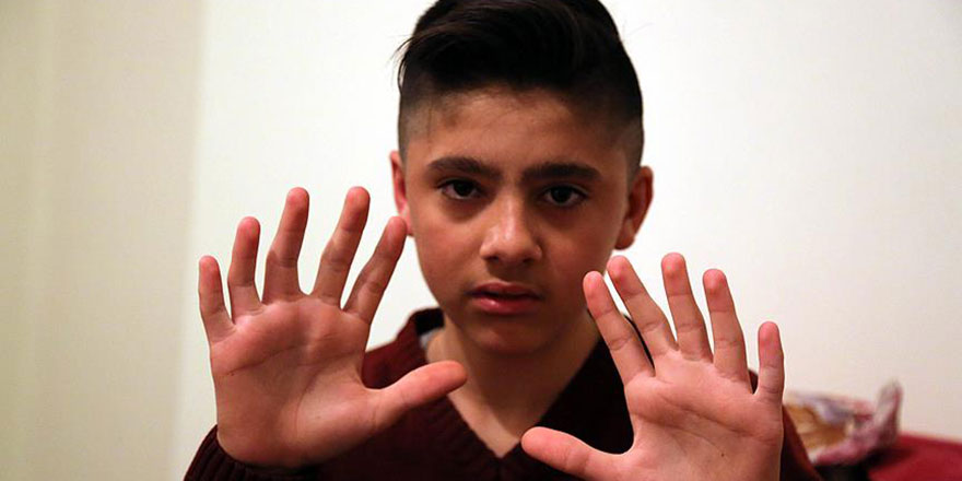 Allah fazladan parmaklı yarattı şikayetçi değil