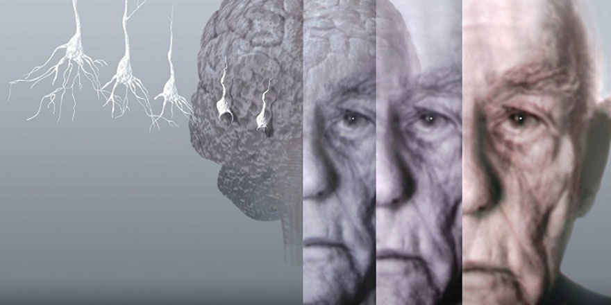 'Alzheimer ile doğru yaşamayı öğrenin'