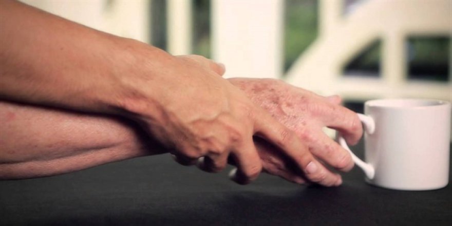 'Her yaşta parkinson riski var'