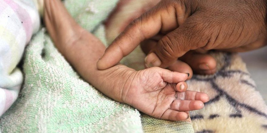 BM'den Yemen için yardım çağrısı