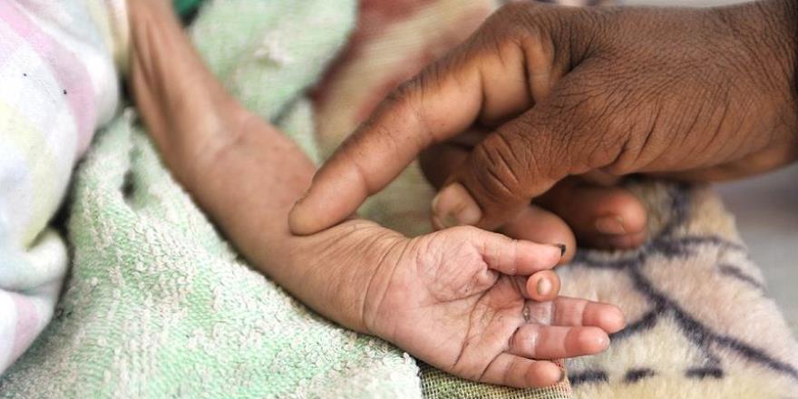 Dünyaya ve körfez ülkelerine Yemen'e yardım çağrısı