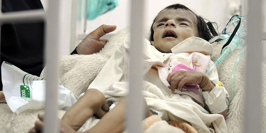 Müslümanlar savaşırken Yemen'de her yıl 66 bin çocuk ölüyor