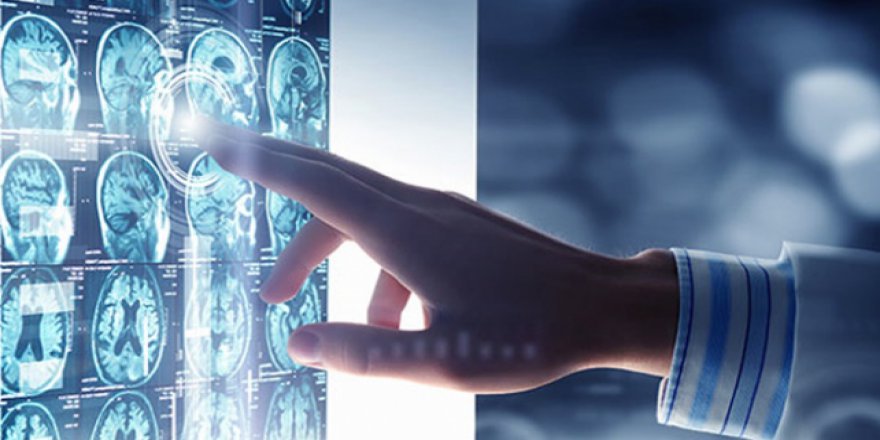 ALS zeki insanlarda daha sık görülüyor'