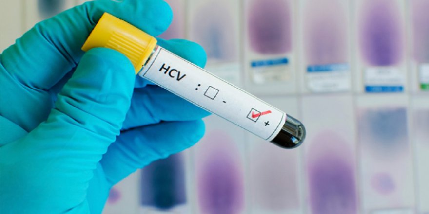 Destekleyici ilaçlar AIDS'ten ölümleri yüzde 27 azaltıyor