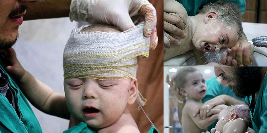 Esed rejimi çatışmasızlık bölgesindeki bebekleri vurdu