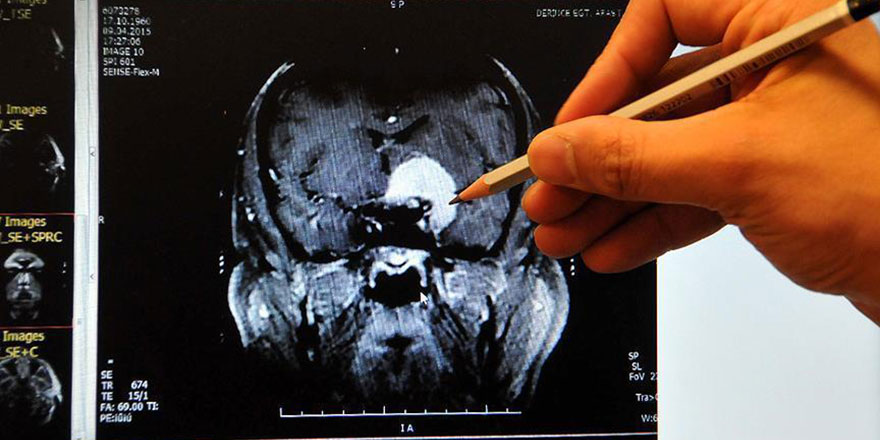 Bağırsak mikropları beyni etkiliyor olabilir