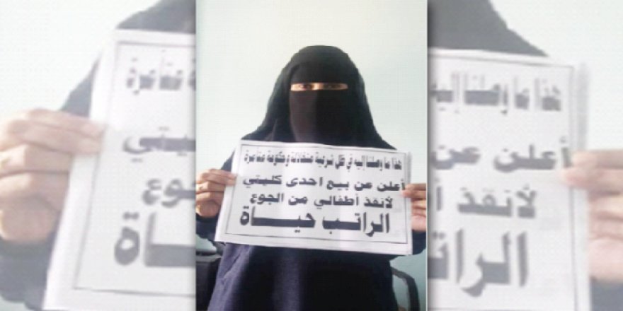 Yemen'de dram! Çocukları için böbreğini satıyor