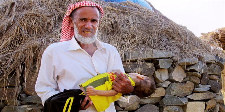 Suudi Arabistan'ın komşusu Yemen'de 10 milyon çocuk yardıma muhtaç!