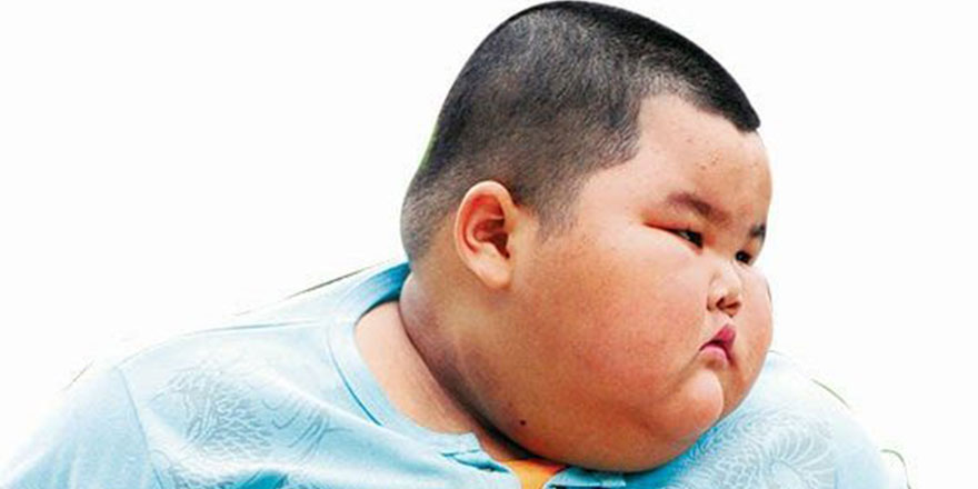 Obezite nedeniyle ameliyat bekleyen 400 bin kişi var