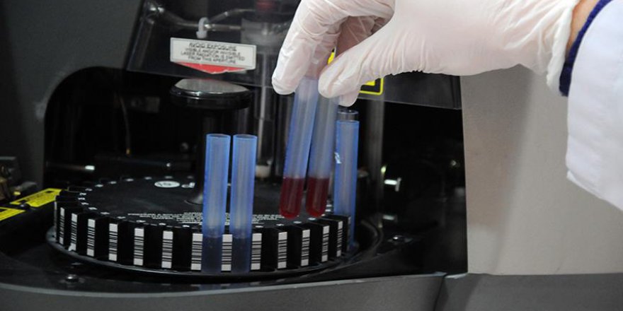 Tedaviye dirençli lenfomada yeni ilaç