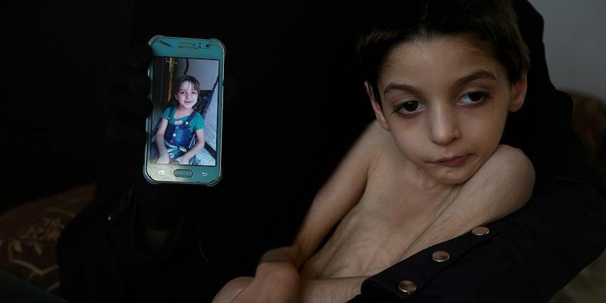 Suriyeli çocuk ölüm döşeğinde açlık çekiyor