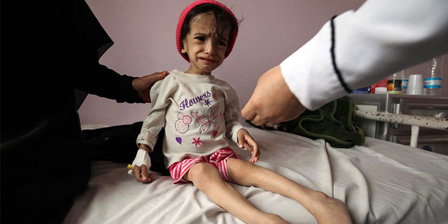 Müslümanlar birbirini öldürdüğü için Yemen'de çocuklar aç kalıyor