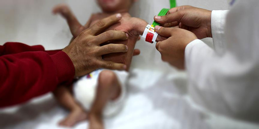 Aşırı kilo tüp bebek riskini azaltıyor