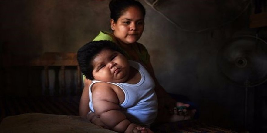 Dünyanın en şişman bebeğine teşhis konulamıyor