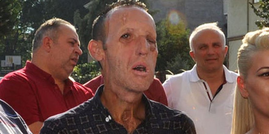 Yüz nakli yapılan Recep Sert tutuklandı