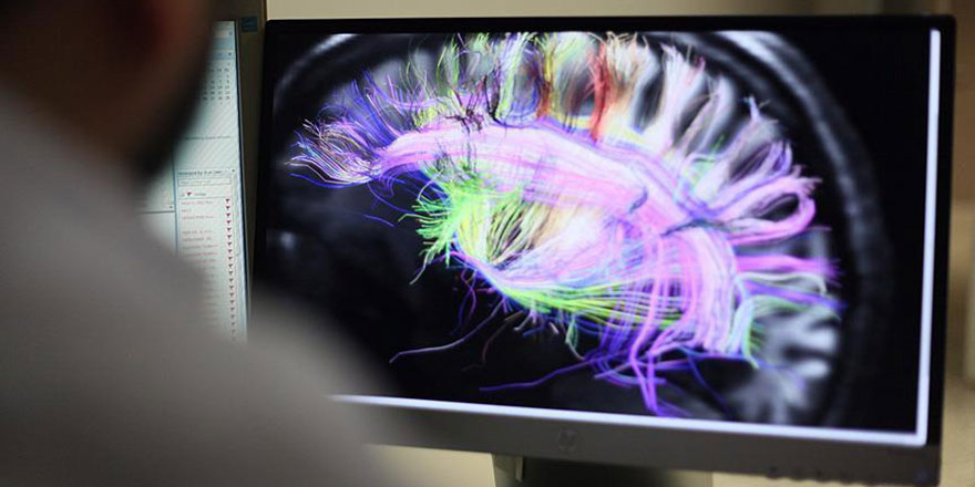 Beynin elektrik bağlantılarının haritası çıkarıldı