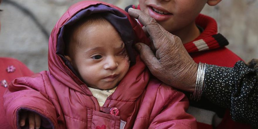 Doğu Gutalı Kerim bebek için destek büyüyor