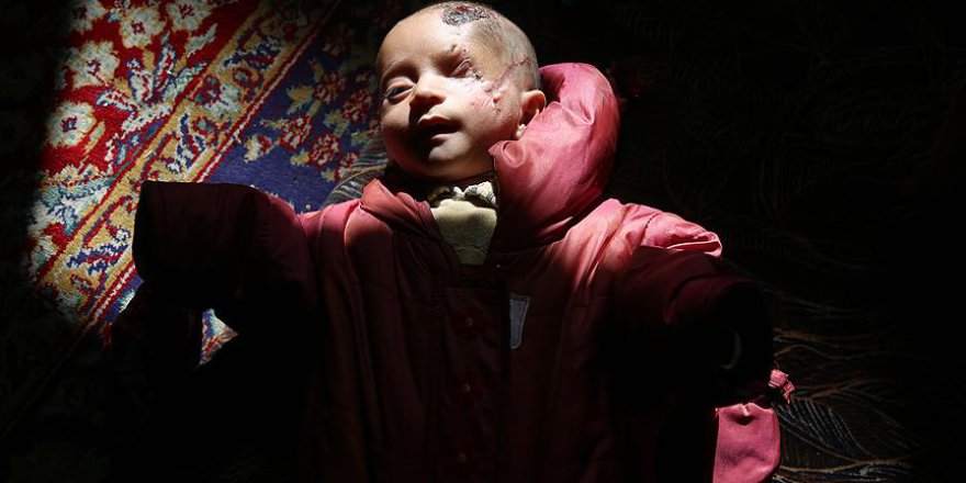 Bakanlar 'Kerim bebeği' unutmadı