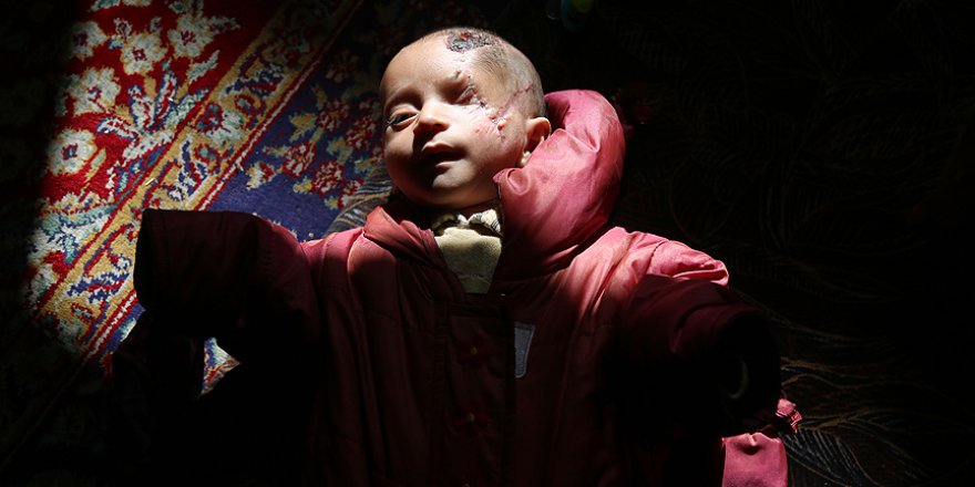 Doğu Guta'nın simgesi Kerim bebeğe destek