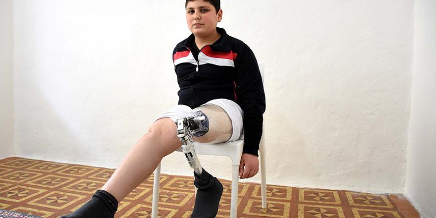 Suriyeli Yusuf'un protez hayali gerçek oldu