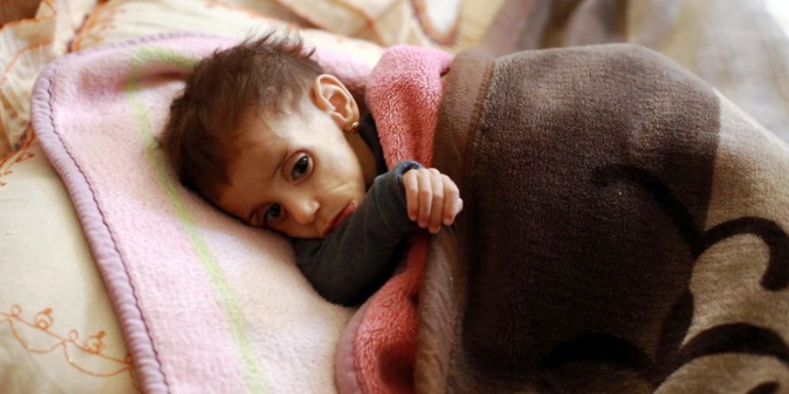 Esed'in pazarlık aracı yaptığı çocuklar tek tek ölüyor