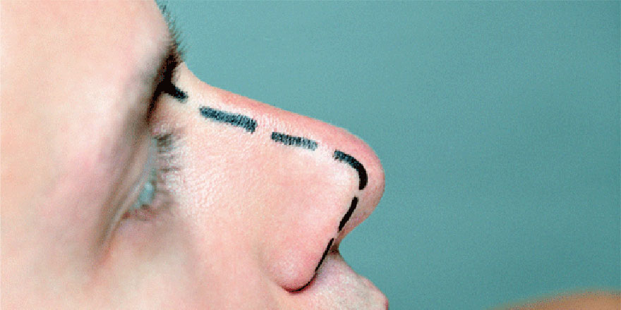 Sosyal medya yüzünden estetiğe talep artıyor