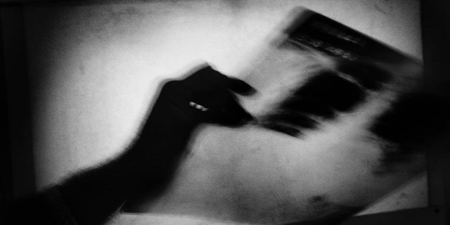 Türkiye 'ince hastalık'ın tedavisinde başarılı