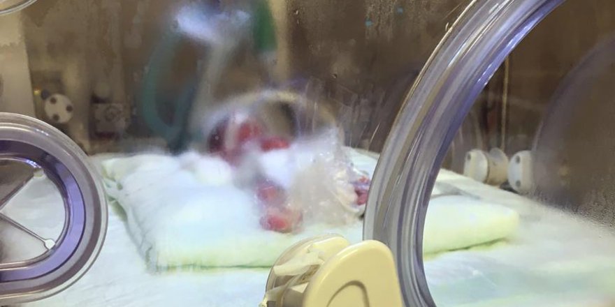 Konya'da 310 gram bebek dünyaya geldi