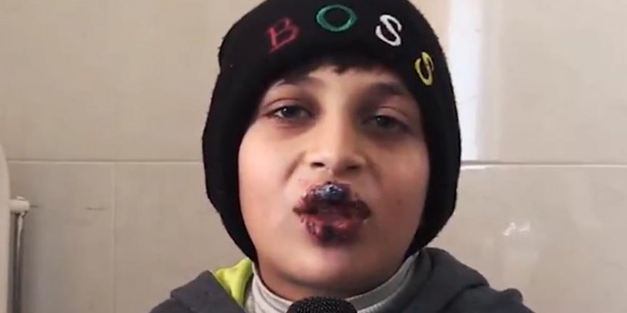 Gazzeli hasta çocuğun yardım çığlığı