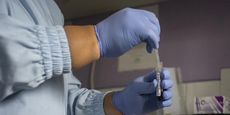 Hindistan'da sahte doktor 21 kişiye AIDS bulaştırdı