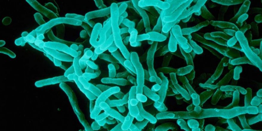 Yemen'de difteri alarmı: 72 ölü