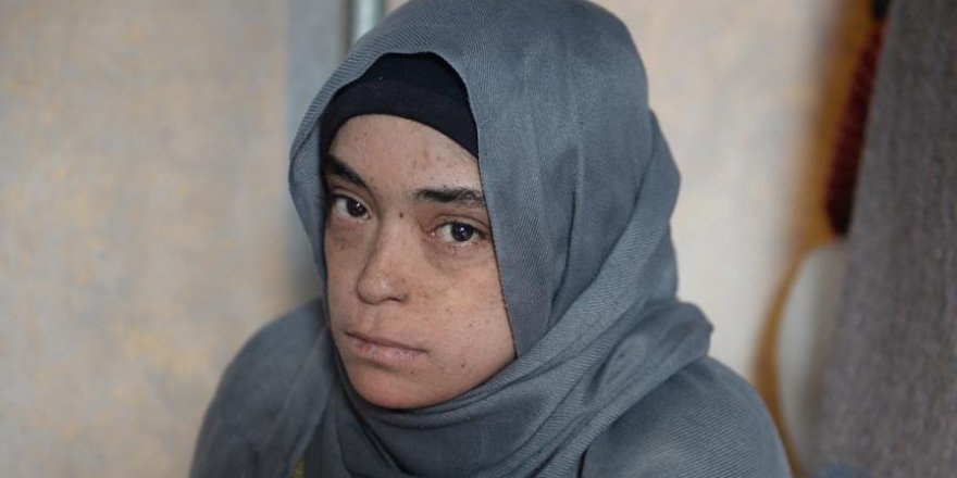 Suriyeli Emine'nin imdadına AFAD yetişti