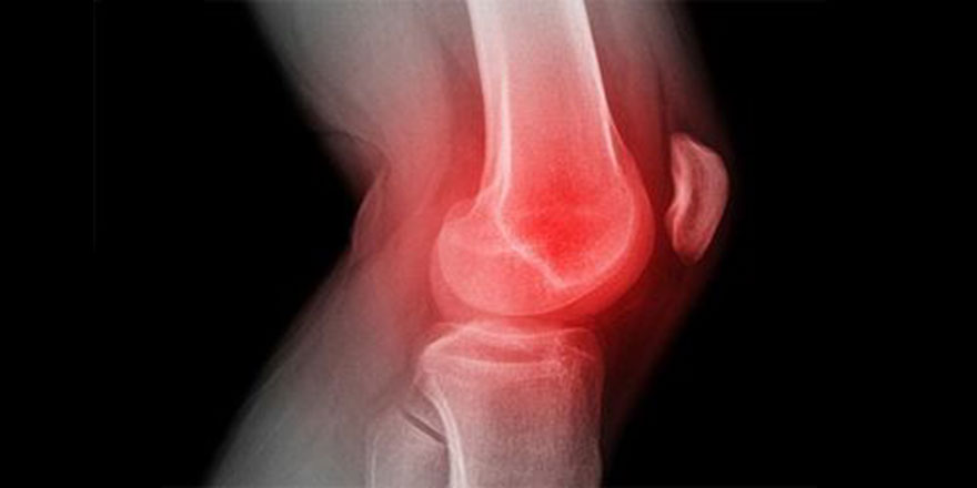 Fazladan 1 kilo dizlerdeki yükü 8 kat artırıyor