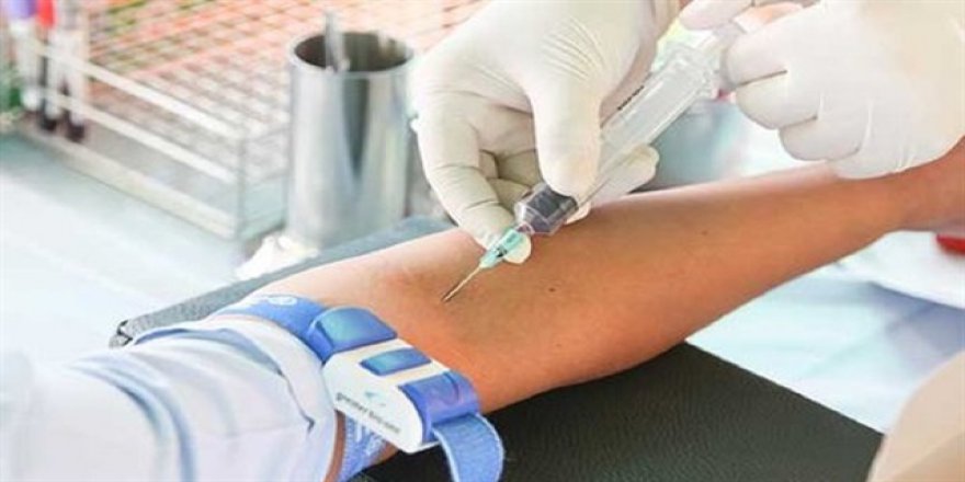 Kan alım şekli sepsisin erken tanısında çok önemli