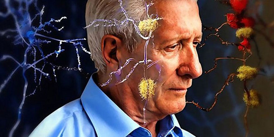 Bunama, küresel halk sağlığı sorunu haline geldi