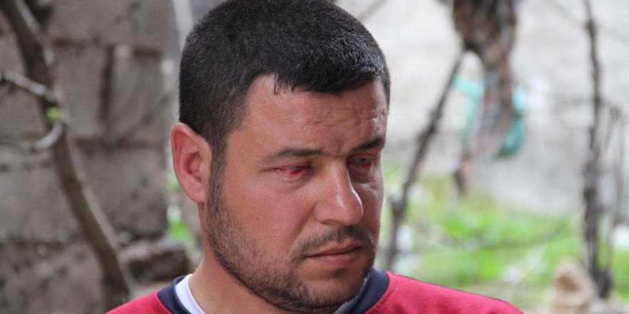 Suriye'de kaybettiği gözleri Türkiye'de açılacak