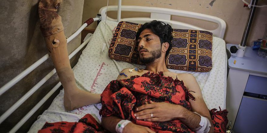 Zalim İsrail, Filistinli genci protez bacağından etti