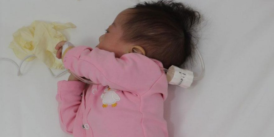 Kalbi delik bebek şifa buldu