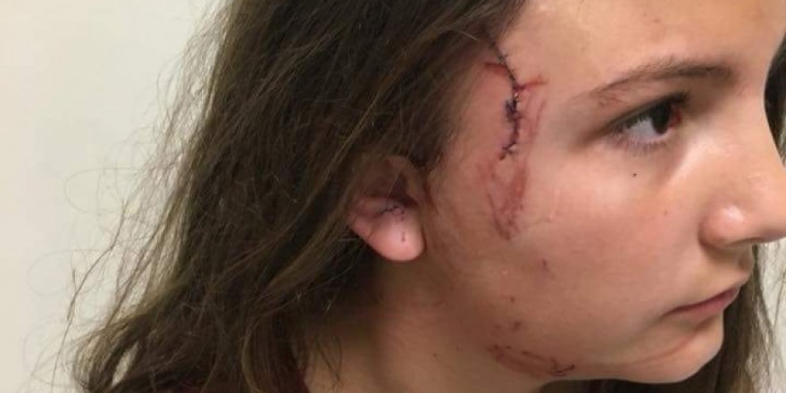 Yine Pitbull dehşeti: Parkta oynayan çocuğa saldırdı