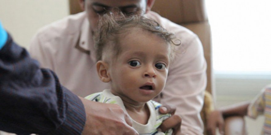 Dünya Sağlık Örgütü Yemen konusunda uyardı