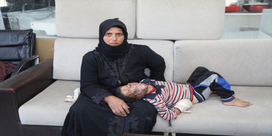 Çadırda yangın sonucu yaralanan Suriyeli Türkiye'de şifa bulacak
